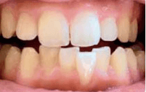 Davide before treatment