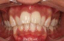 Khadija before treatment