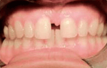 Marie before treatment