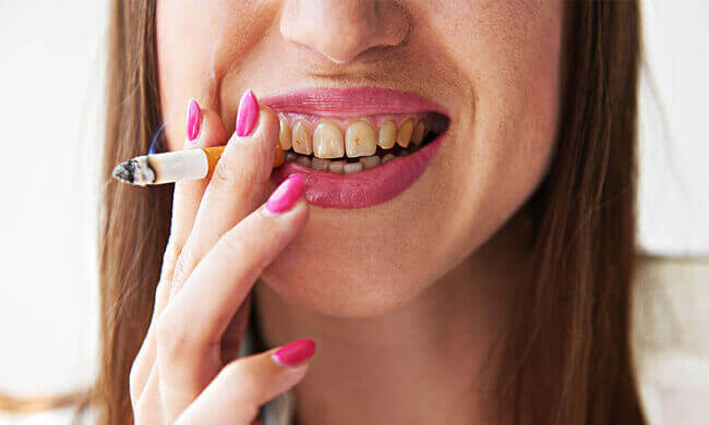 Smoking and Oral Health